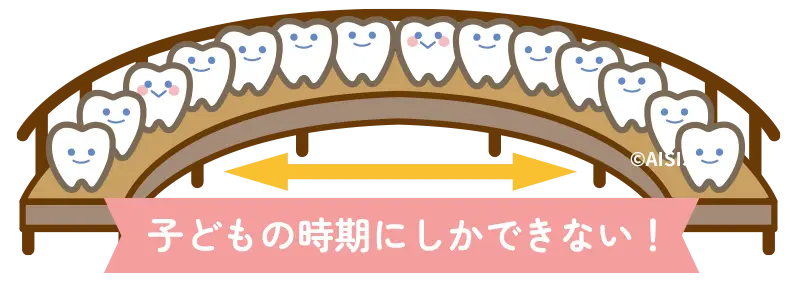 非抜歯矯正