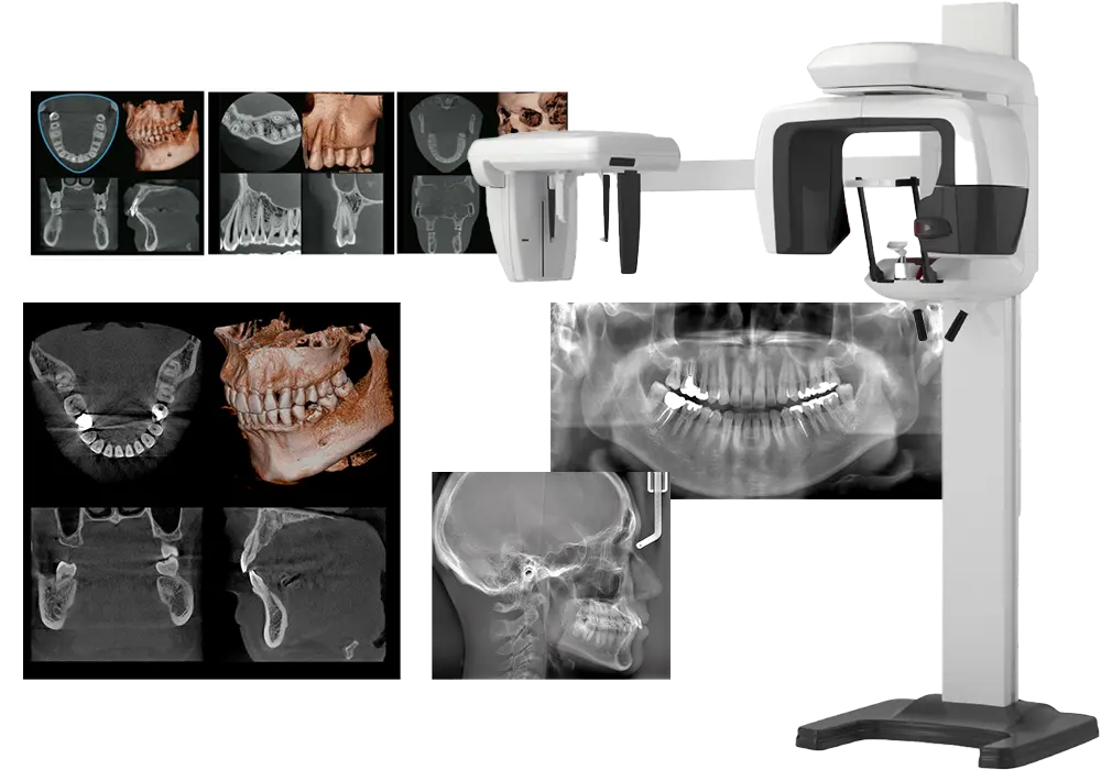 歯科用CT・デジタルレントゲン