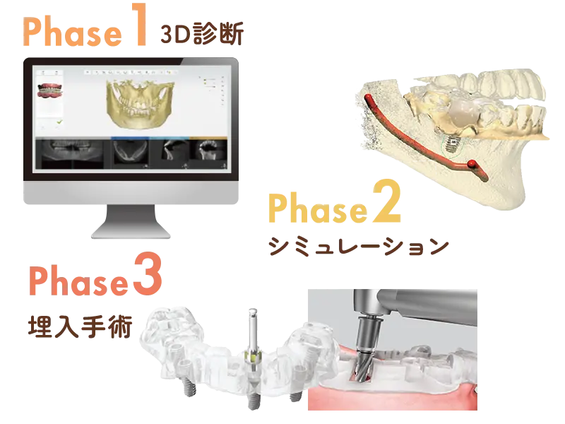 オステムワンガイド