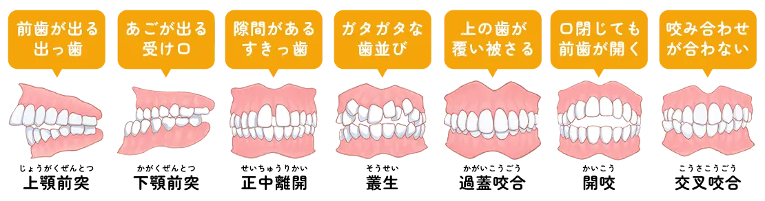 矯正歯科
