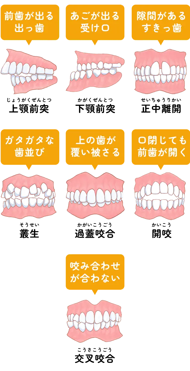 矯正歯科